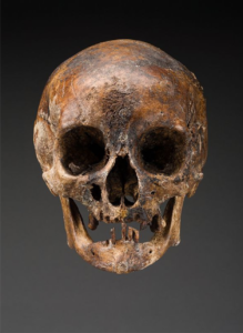image of skull